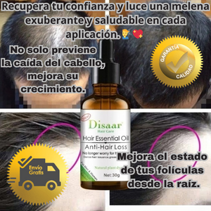 Suero capilar para combatir la calvicie con envío gratis, PAGA 2 & LLEVA 3💇‍♂️💖